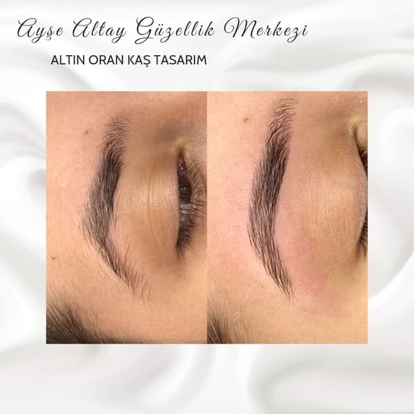 Ayşe Altay Güzellik Merkezi - 144. Fotoğraf