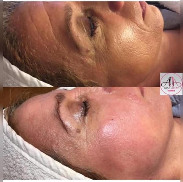 Ayşe Alya Güzellik Merkezi - 84. Fotoğraf Ayşe Alya Güzellik Merkezi - 84. Fotoğraf