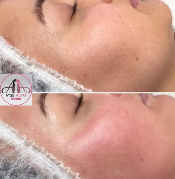 Ayşe Alya Güzellik Merkezi - 82. Fotoğraf Ayşe Alya Güzellik Merkezi - 82. Fotoğraf