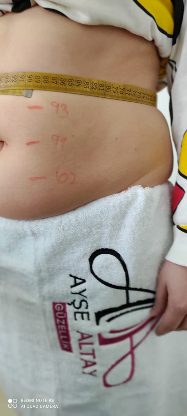 Ayşe Alya Güzellik Merkezi - 5. Fotoğraf Ayşe Alya Güzellik Merkezi - 5. Fotoğraf