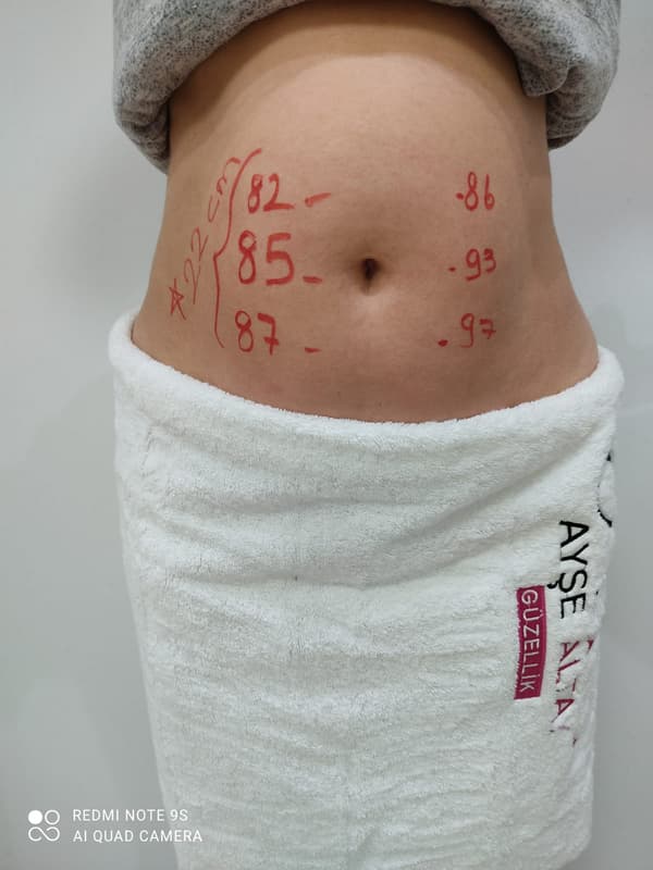 Ayşe Alya Güzellik Merkezi - 9. Fotoğraf Ayşe Alya Güzellik Merkezi - 9. Fotoğraf