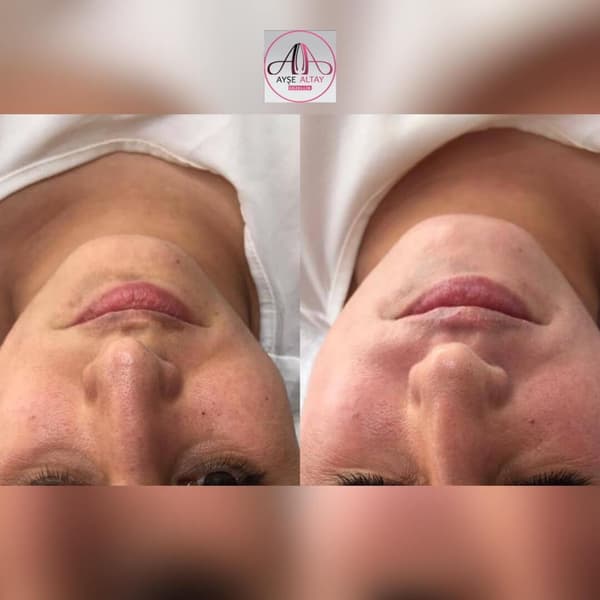 Ayşe Alya Güzellik Merkezi - 136. Fotoğraf Ayşe Alya Güzellik Merkezi - 136. Fotoğraf