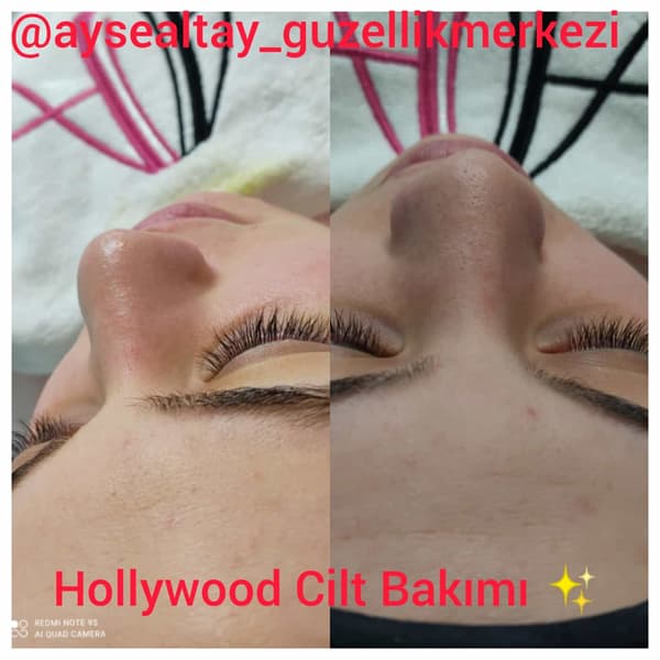 Ayşe Alya Güzellik Merkezi - 60. Fotoğraf Ayşe Alya Güzellik Merkezi - 60. Fotoğraf