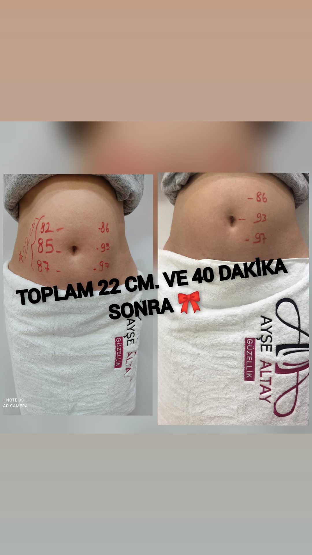 Ayşe Alya Güzellik Merkezi