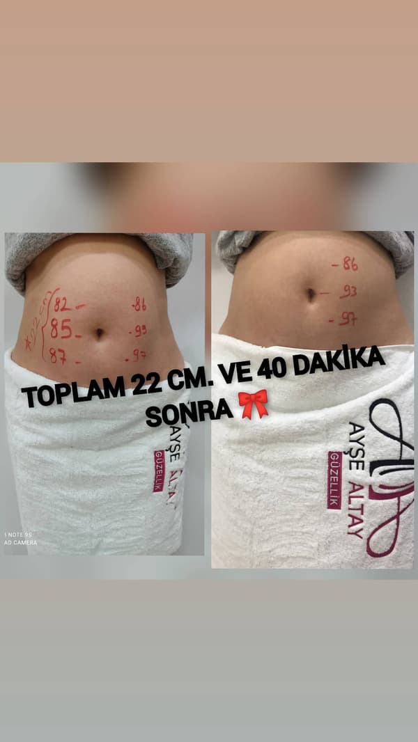 Ayşe Altay Güzellik Merkezi - 71. Fotoğraf