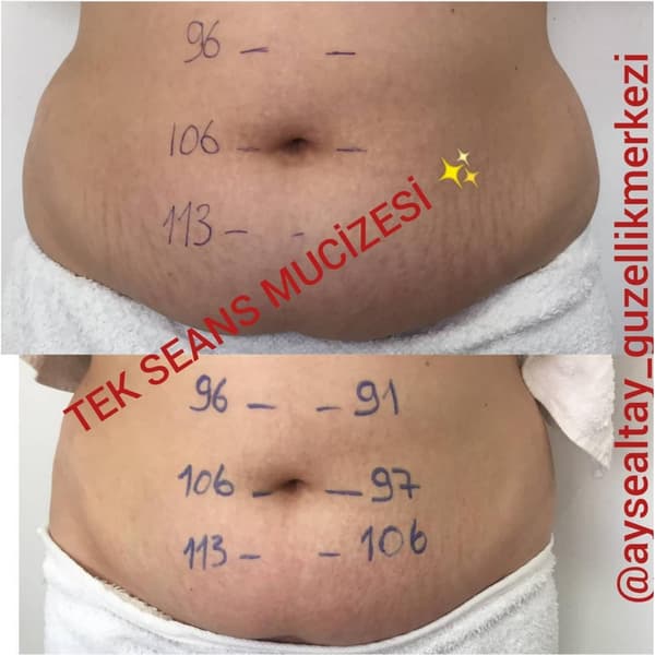 Ayşe Alya Güzellik Merkezi - 15. Fotoğraf Ayşe Alya Güzellik Merkezi - 15. Fotoğraf