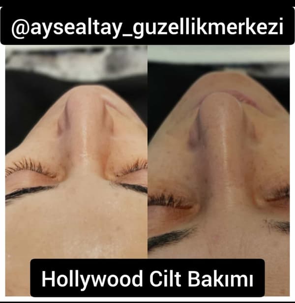 Ayşe Alya Güzellik Merkezi - 63. Fotoğraf Ayşe Alya Güzellik Merkezi - 63. Fotoğraf