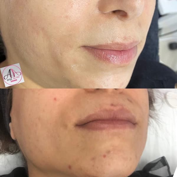 Ayşe Alya Güzellik Merkezi - 89. Fotoğraf Ayşe Alya Güzellik Merkezi - 89. Fotoğraf