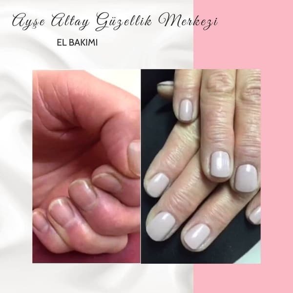 Ayşe Alya Güzellik Merkezi - 147. Fotoğraf Ayşe Alya Güzellik Merkezi - 147. Fotoğraf