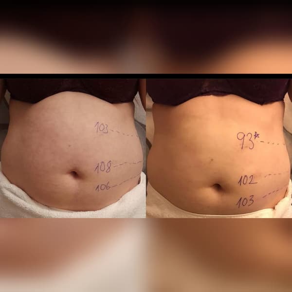 Ayşe Alya Güzellik Merkezi - 53. Fotoğraf Ayşe Alya Güzellik Merkezi - 53. Fotoğraf