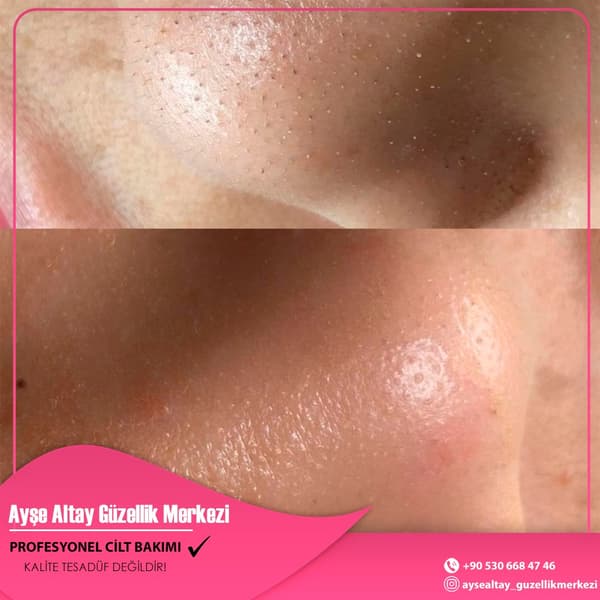 Ayşe Alya Güzellik Merkezi - 68. Fotoğraf Ayşe Alya Güzellik Merkezi - 68. Fotoğraf