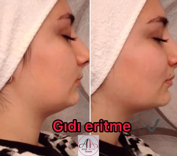 Ayşe Altay Güzellik Merkezi - 81. Fotoğraf