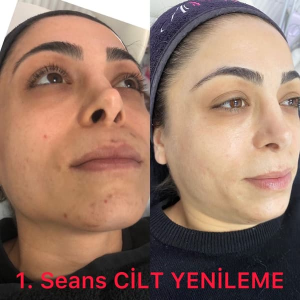 Ayşe Altay Güzellik Merkezi - 90. Fotoğraf