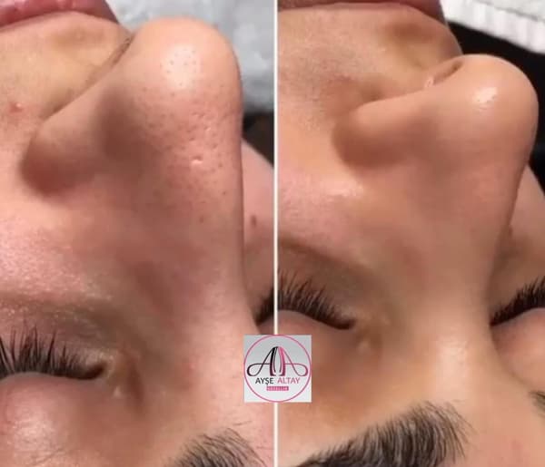 Ayşe Alya Güzellik Merkezi - 78. Fotoğraf Ayşe Alya Güzellik Merkezi - 78. Fotoğraf