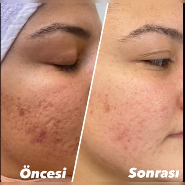 Ayşe Alya Güzellik Merkezi - 121. Fotoğraf Ayşe Alya Güzellik Merkezi - 121. Fotoğraf