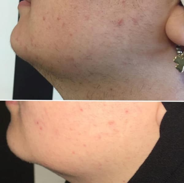 Ayşe Alya Güzellik Merkezi - 99. Fotoğraf Ayşe Alya Güzellik Merkezi - 99. Fotoğraf