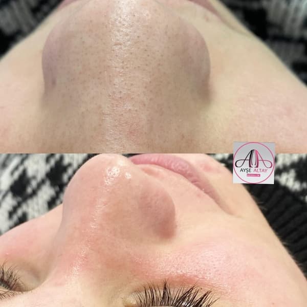 Ayşe Alya Güzellik Merkezi - 132. Fotoğraf Ayşe Alya Güzellik Merkezi - 132. Fotoğraf