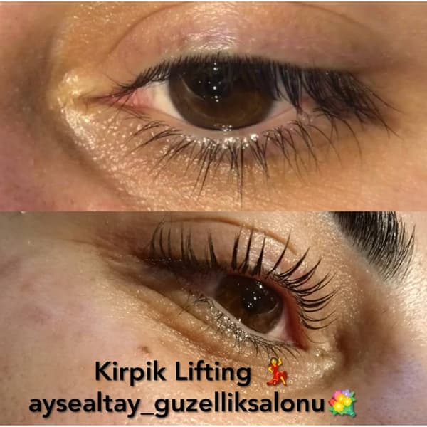 Ayşe Altay Güzellik Merkezi - 54. Fotoğraf