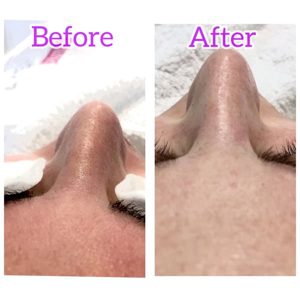 Ayşe Alya Güzellik Merkezi - 67. Fotoğraf Ayşe Alya Güzellik Merkezi - 67. Fotoğraf