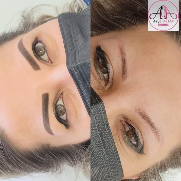 Ayşe Alya Güzellik Merkezi - 116. Fotoğraf Ayşe Alya Güzellik Merkezi - 116. Fotoğraf