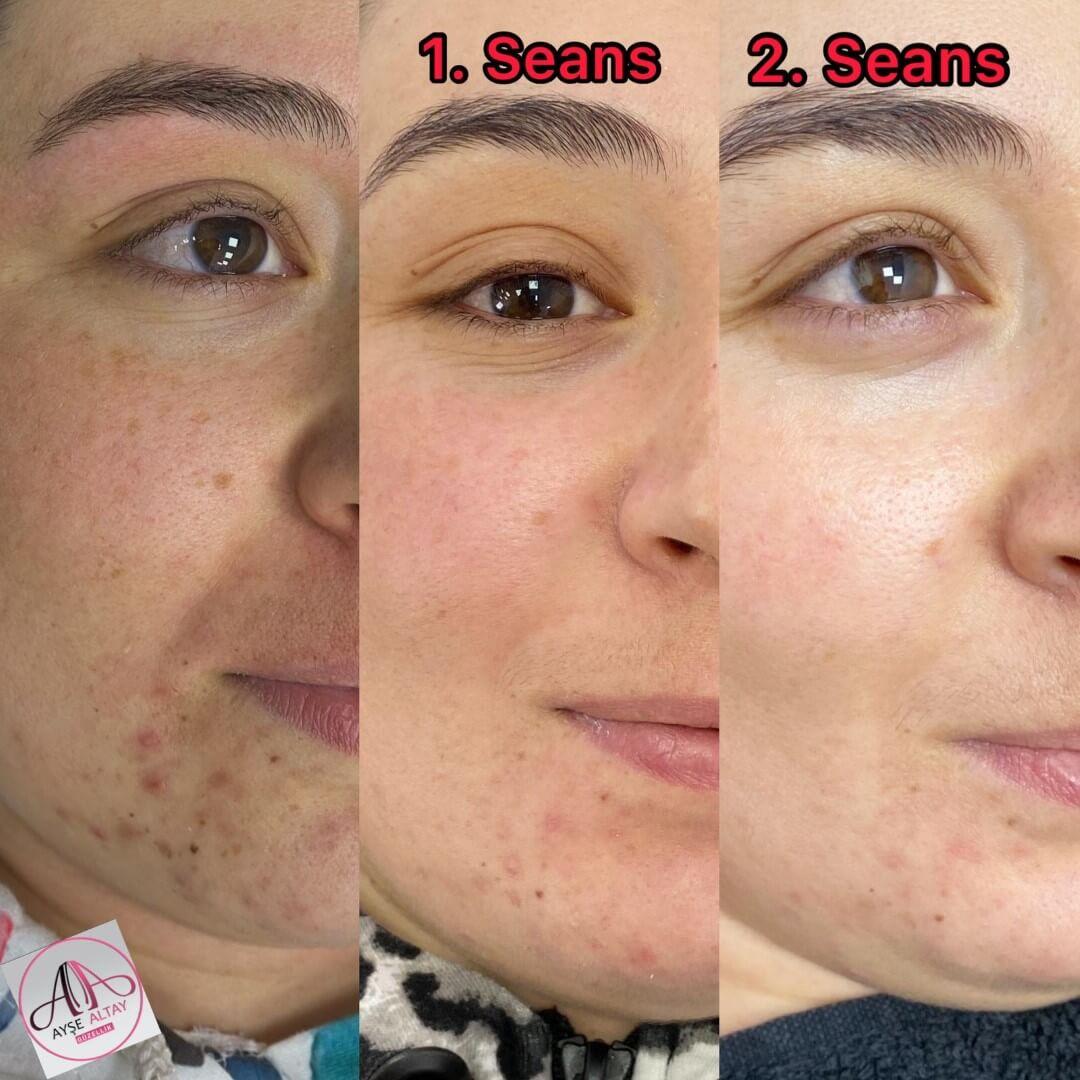 Ayşe Alya Güzellik Merkezi