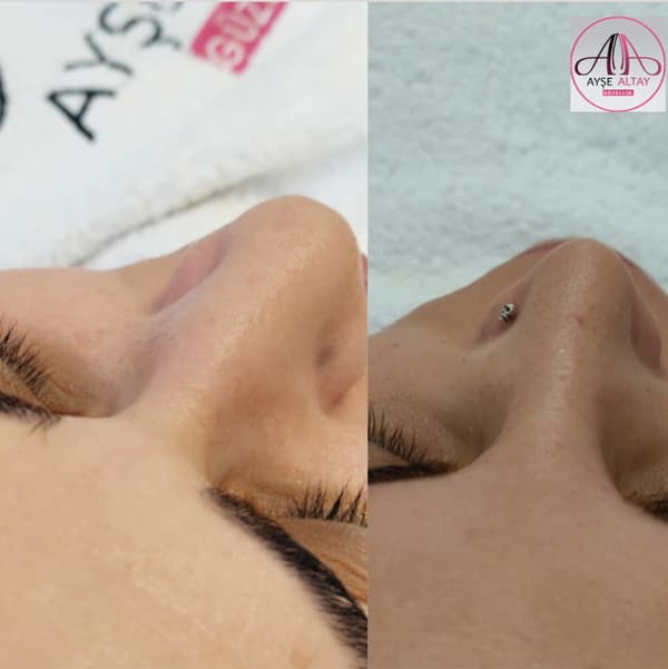 Ayşe Alya Güzellik Merkezi - 76. Fotoğraf Ayşe Alya Güzellik Merkezi - 76. Fotoğraf