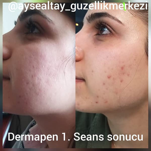 Ayşe Altay Güzellik Merkezi - 58. Fotoğraf