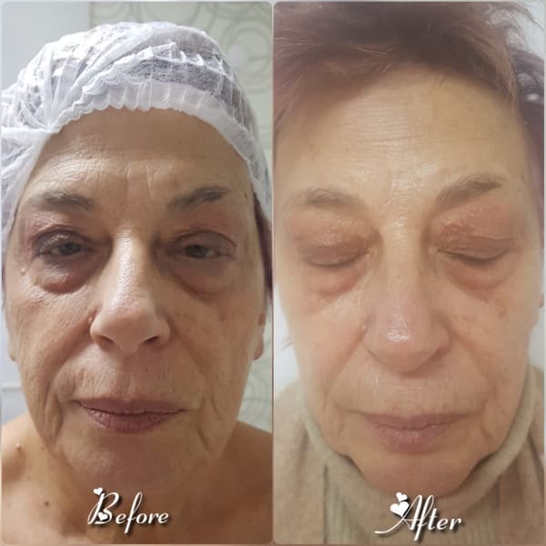 Nadire Güzellik Salonu - 23. Fotoğraf