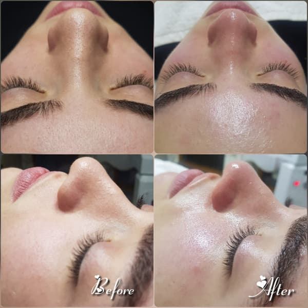 Nadire Güzellik Salonu - 21. Fotoğraf Nadire Güzellik Salonu - 21. Fotoğraf