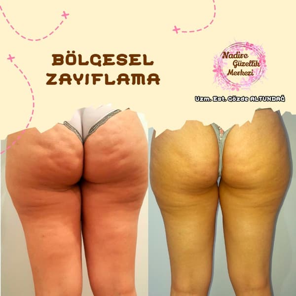 Nadire Güzellik Salonu - 66. Fotoğraf