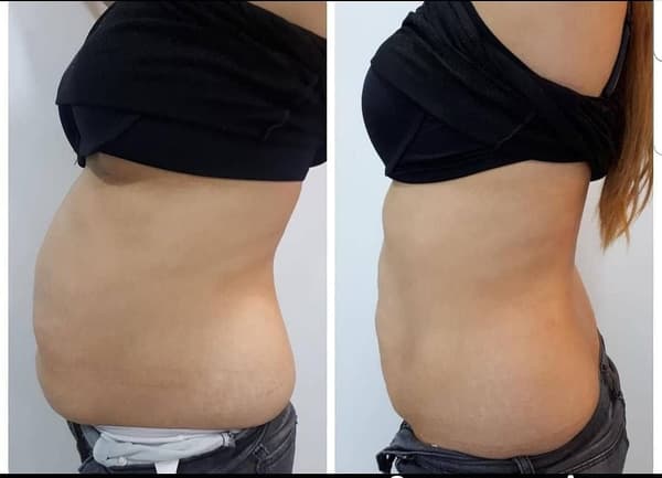 Nadire Güzellik Salonu - 55. Fotoğraf Nadire Güzellik Salonu - 55. Fotoğraf