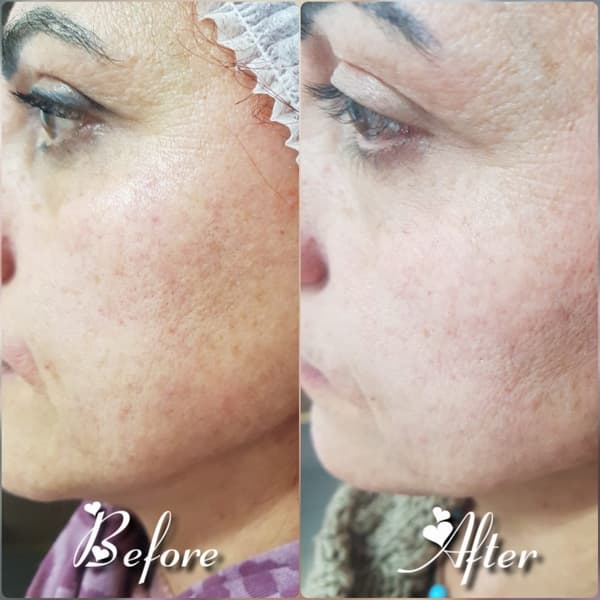 Nadire Güzellik Salonu - 42. Fotoğraf Nadire Güzellik Salonu - 42. Fotoğraf