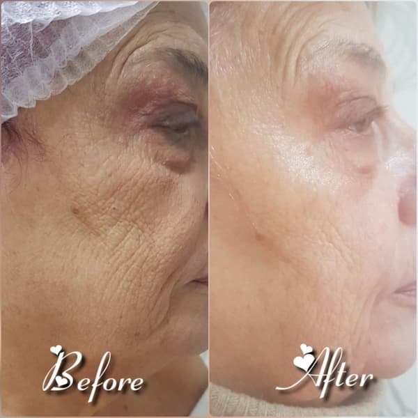 Nadire Güzellik Salonu - 22. Fotoğraf Nadire Güzellik Salonu - 22. Fotoğraf