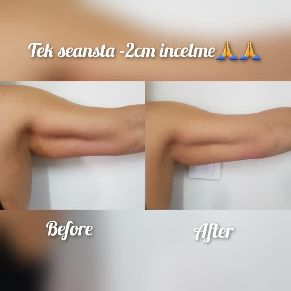 Nadire Güzellik Salonu - 50. Fotoğraf Nadire Güzellik Salonu - 50. Fotoğraf