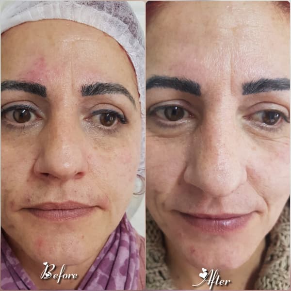 Nadire Güzellik Salonu - 26. Fotoğraf