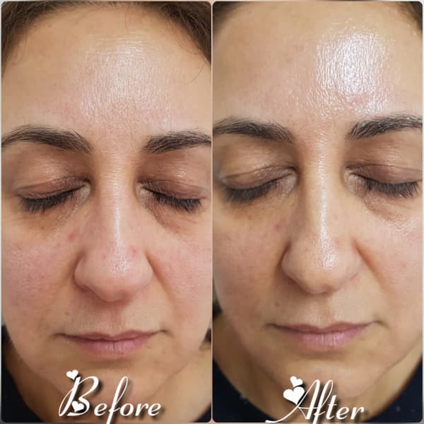 Nadire Güzellik Salonu - 29. Fotoğraf Nadire Güzellik Salonu - 29. Fotoğraf