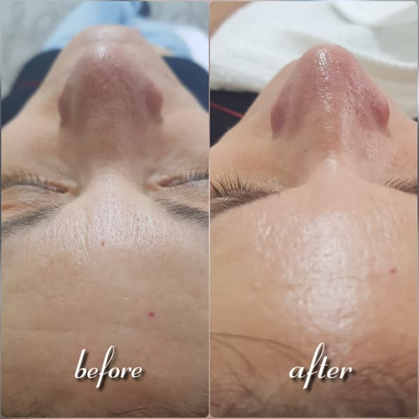 Nadire Güzellik Salonu - 35. Fotoğraf Nadire Güzellik Salonu - 35. Fotoğraf