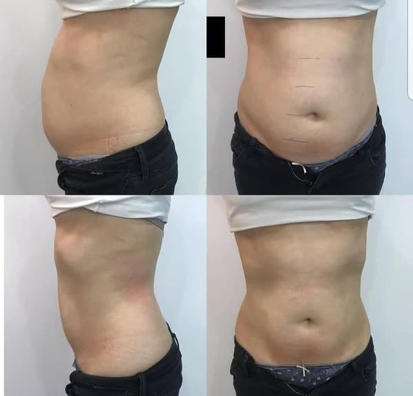 Nadire Güzellik Salonu - 52. Fotoğraf Nadire Güzellik Salonu - 52. Fotoğraf