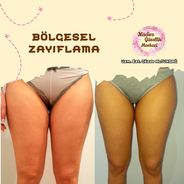 Nadire Güzellik Salonu - 64. Fotoğraf Nadire Güzellik Salonu - 64. Fotoğraf