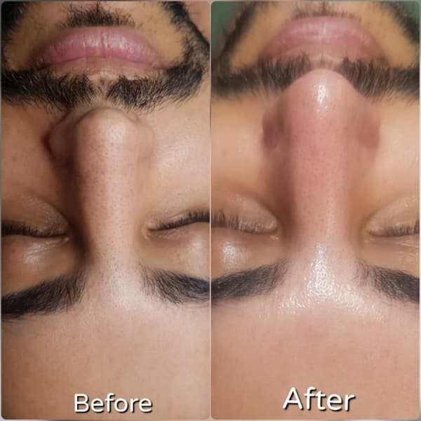 Nadire Güzellik Salonu - 58. Fotoğraf Nadire Güzellik Salonu - 58. Fotoğraf