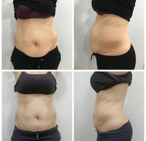 Nadire Güzellik Salonu - 59. Fotoğraf Nadire Güzellik Salonu - 59. Fotoğraf