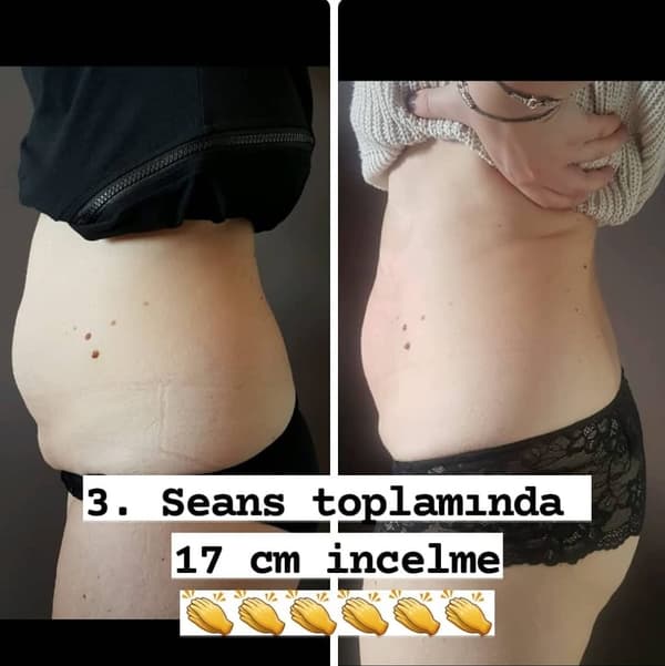 Nadire Güzellik Salonu - 53. Fotoğraf Nadire Güzellik Salonu - 53. Fotoğraf