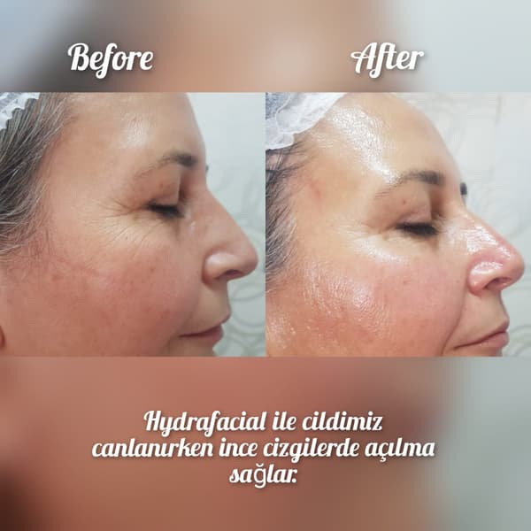 Nadire Güzellik Salonu - 16. Fotoğraf Nadire Güzellik Salonu - 16. Fotoğraf