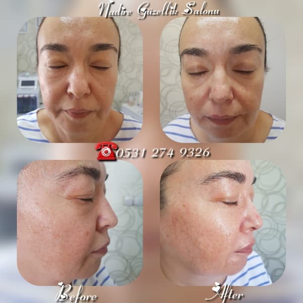 Nadire Güzellik Salonu - 18. Fotoğraf Nadire Güzellik Salonu - 18. Fotoğraf