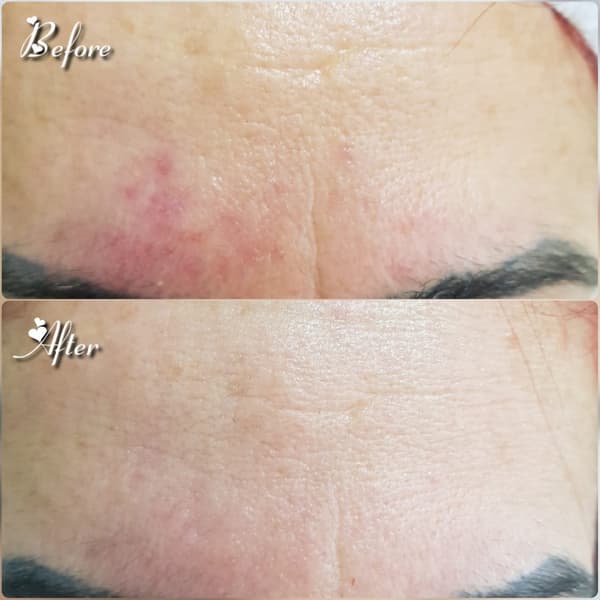 Nadire Güzellik Salonu - 30. Fotoğraf Nadire Güzellik Salonu - 30. Fotoğraf