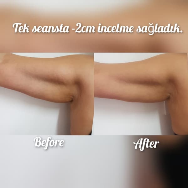 Nadire Güzellik Salonu - 13. Fotoğraf