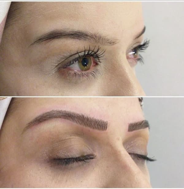 Estemedic Güzellik Merkezi - 3. Fotoğraf Estemedic Güzellik Merkezi - 3. Fotoğraf