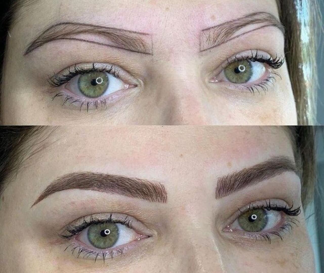 Estemedic Güzellik Merkezi - Tunalı Güzellik Merkezleri - 4. Fotoğraf