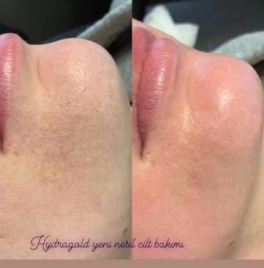 Estemedic Güzellik Merkezi