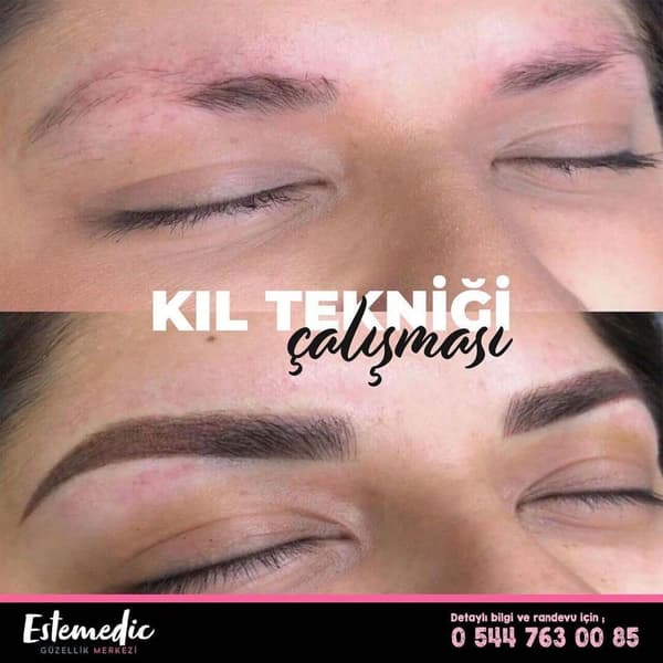 Estemedic Güzellik Merkezi - 7. Fotoğraf